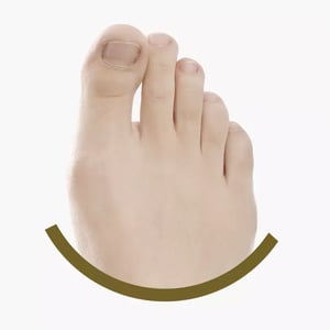 neuroma-morton-min.jpg