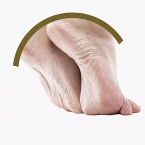 piede-cavo