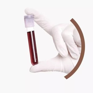 prp-medicina-rigenerativa