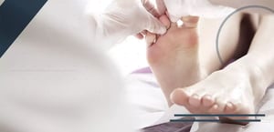 alluce-valgo-le-principali-tecniche-chirurgiche-min