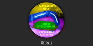 Dr. Usuelli - cartilagina e caviglia